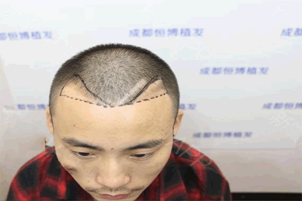 㲩ֲ˷ѡ